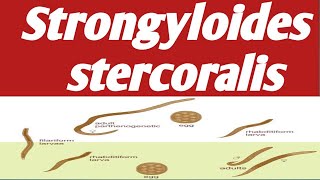 Strongyloides stercoralis  Ahmaric Tutorial [upl. by Treat]