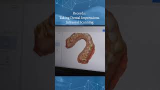 Records Taking Dental Impressions Intraoral Scanning [upl. by Araet]