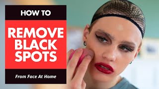 How To Remove Black Spots From Face At Home [upl. by Durward]