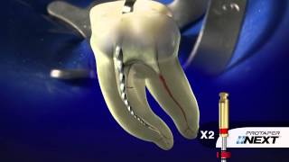 PROTAPER NEXT® Clinical with Dr Ruddle  Dentsply Sirona [upl. by Popper531]