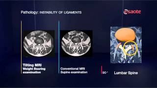 ESAOTE Tilting MRI  Add weight to your diagnosis with Gscan [upl. by Ketti235]