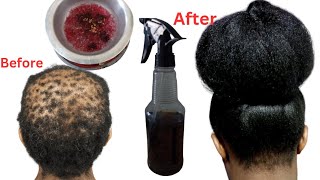 Her dermatologist didnt help She used this natural hair treatment her hair is so long and bushy [upl. by Quartet]