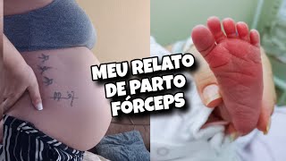 MEU RELATO DE PARTO NORMAL COM FÓRCEPS [upl. by Maryrose]