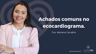 Achados comuns no ecocardiograma pediátrico [upl. by Nelson]