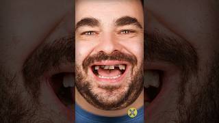 Dientes de tus antepasados 👉🦷 curiosidades [upl. by Lonne]