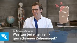 Was tun bei einem eingewachsenen Zehennagel  Dr Johannes Wimmer [upl. by Weeks]