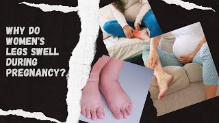 Why do womens legs swell during pregnancy [upl. by Aynekal]