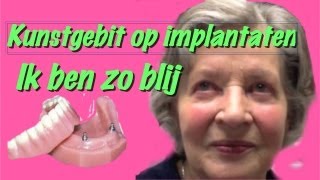 Kunstgebit op implantatenhet klikgebit gemaakt in Amsterdam Zuidoost [upl. by Ecurb]