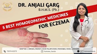 Best homeopathic medicines for Eczemaएक्जिमा का जड़ से इलाजDERMATITISDR ANJALI GARGHOMOEO HANDS [upl. by Brenden]