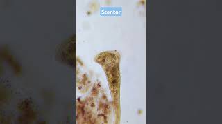 Early morning beautiful stentor under the microscope [upl. by Gentry]