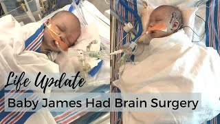 Life Update  Baby James Had Surgery [upl. by Seraphim146]