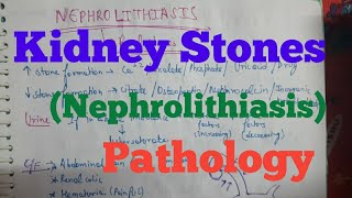 Kidney Stones  Nephrolithiasis Pathology [upl. by Haase303]