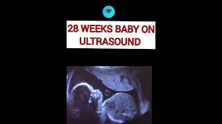 28 weeks baby on ultrasound pregnant ultrasound pregnancare [upl. by Treb]