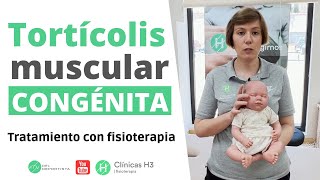 Tratamiento tortícolis muscular congénita 👶 Clínica H3 fisioterapia 2024 [upl. by Middlesworth445]