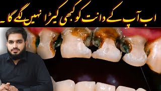 آپ کے دانت کو کبھی کیڑا نہیں لگے گا   Never get a cavity in your TOOTH drmuneermalik [upl. by Rutger]