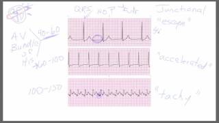 Junctional Rhythms [upl. by Reichel336]