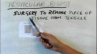 How to Perform a Testicular Cancer Exam  What is a Testicular Biopsy [upl. by Britta38]