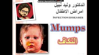 mumps النكاف [upl. by Kaine]