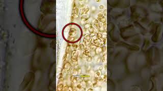 White blood cells ATTACK giant parasite worm [upl. by Nordna]