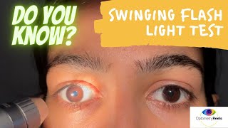 Swinging flash light test II How to examine RAPD II Assess relative afferent pupillary defect [upl. by Casanova678]