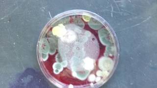 Penicillium dermatophytes micoconidia macroconidia hyphae conidia phialides [upl. by Suolhcin]