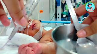 Og Tube feeding  Og Tube Feeding For Newborn  Tube Feeding procedure  NICU viralvideo new cute [upl. by Divadnoj154]