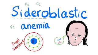 Sideroblastic Anemia [upl. by Patty]