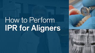 How to Perform IPR for Reveal® Clear Aligners [upl. by Opportina772]