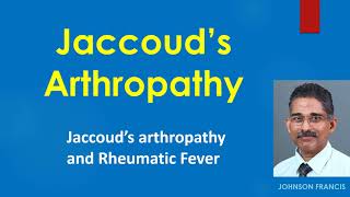 Jaccoud’s Arthropathy [upl. by Lertnek400]