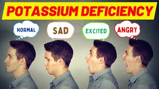 10 Signs You Have a Potassium Deficiency and What to Do About It [upl. by Anigue]