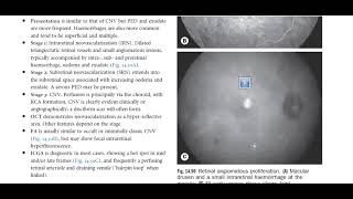 Kanski Clinical Ophthalmology Made Easy  Macula 7 PCV  RAP [upl. by Ianthe]