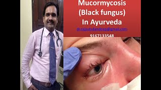 Mucormycosis definition and treatment according to ayurveda black fungus [upl. by Townsend]