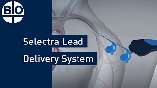 Enhancing CRT with Selectra Lead Delivery System [upl. by Wenz959]