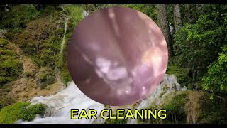 EAR INFECTION DISCHARGE REMOVED FROM BOTH EARS  EAR CLEANING [upl. by Adok]