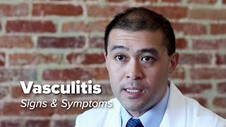 Vasculitis Signs amp Symptoms  Johns Hopkins Medicine [upl. by Glendon]