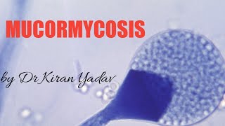 Microbiology lectures Mucormycosis Mycology [upl. by Perla]