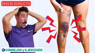 🔴 Mi experiencia con Roturas musculares  ejercicios y consejos 🔴 V [upl. by Atikam]