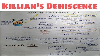 Killians dehiscence  Pharynx  Dr Pawan nagar [upl. by Ardnaeel]