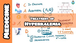 Treating Hyperkalemia usmle firstaid for inicet nclex neetpg with mnemonic [upl. by Anahgem]