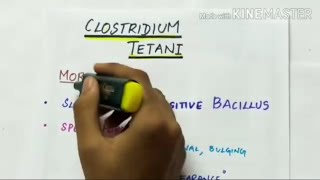 clostridium tetani  microbiology  handwritten notes [upl. by Ziza]