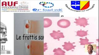 MORPHOLOGIE EN HEMATOLOGIE EPISODE 2 [upl. by Loziram]