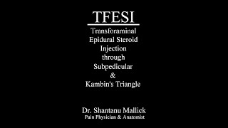 TFESI through Subpedicular amp Kambins triangle approach [upl. by Matthus]