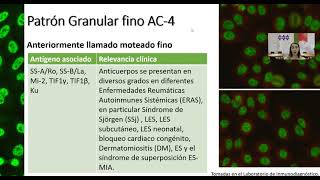 Inmunofluorescencia en el diagnóstico de enfermedades autoinmunes  Lcda Samantha Gutierrez [upl. by Maleen]