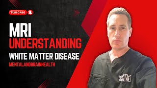 Decoding MRI Understanding White Matter Disease with Dr Raphi Wald mentalandbrainhealth [upl. by Atina]