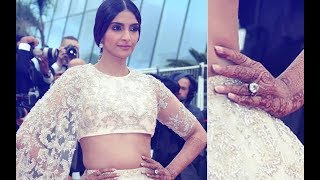 This Is How Much Sonam Kapoor’s Engagement Ring Cost  SpotboyE [upl. by Nitsur]