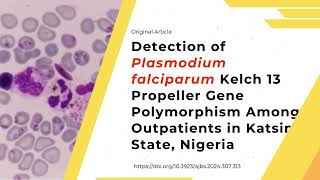 Detection of Plasmodium falciparum Kelch 13 Propeller Gene Polymorphism Among Outpatients [upl. by Amberly]