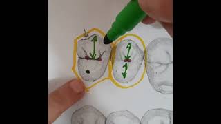 Diferenças do 1 e 2 pre molar superior [upl. by Tildie]