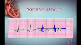 Intro EKG Interpretation Part 1 [upl. by Essirahs366]