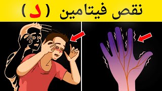 12 علامة تحذيرية أنك تعاني من نقص فيتامين د  لا تتجاهل هذه العلامات [upl. by Oleg244]