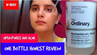 How to use Niacinamide 10  zinc1 serum hindi  Ordinary niacinamide serum 30 days honest review [upl. by Locke]